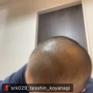 純粋さ